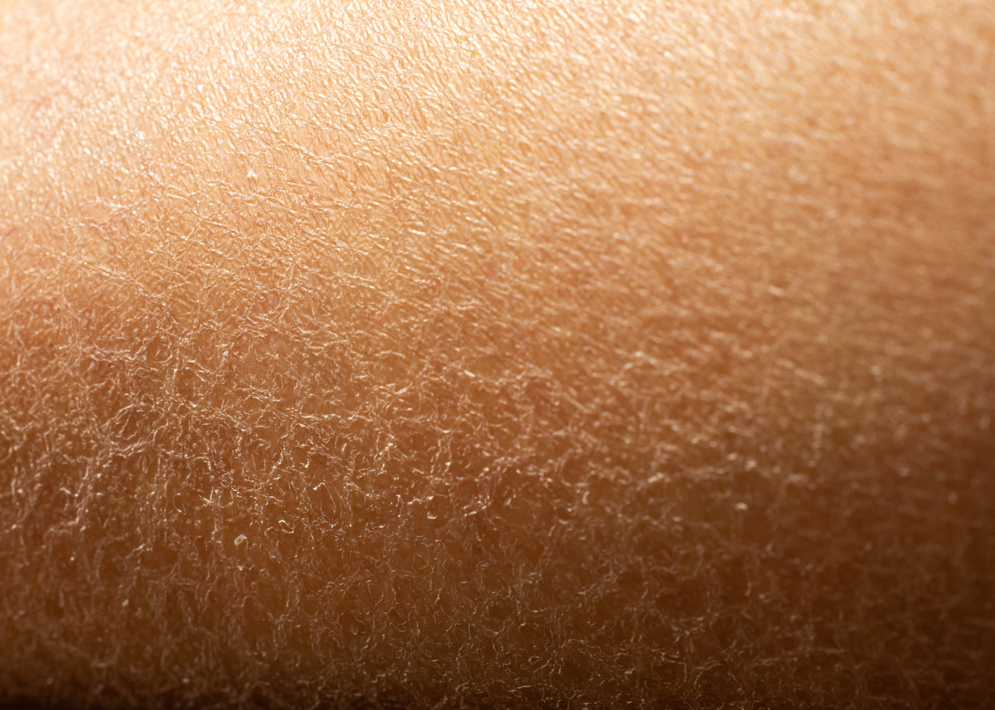 Close up of dry, flaky skin 